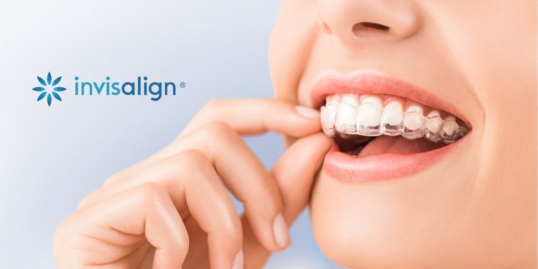 Invisalign aligner therapy