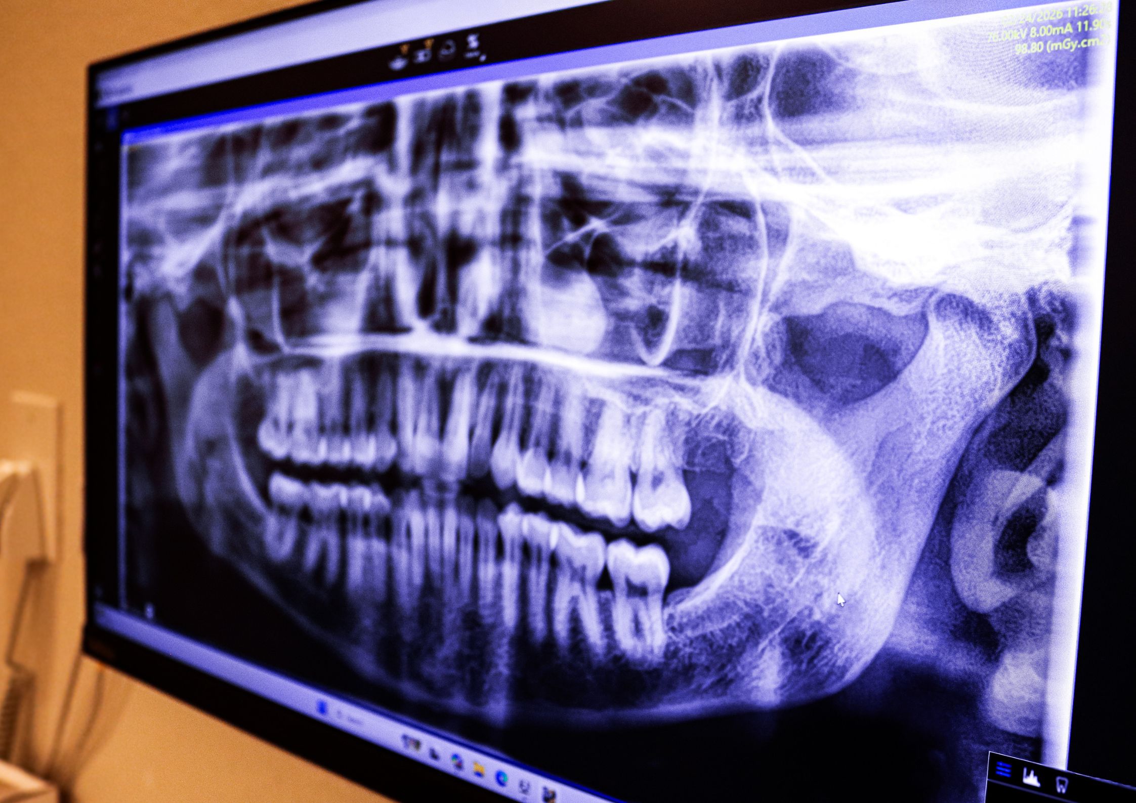 Sedation dentistry in McGregor